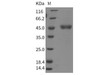 Rat Cathepsin E/CTSE Recombinant Protein (His Tag) (RPES3119)