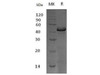 Mouse TNFRSF13B/TACI/CD267 Recombinant Protein (RPES3130)
