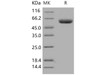 Human DPP7/DPPII/DPP2 Recombinant Protein (RPES3143)