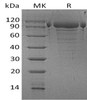 Human PDILT Recombinant Protein (RPES3147)