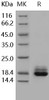 Human Cystatin C/CST3 Recombinant Protein (RPES3159)