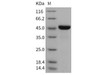 Mouse LRPAP1/A2MRAP Recombinant Protein (His Tag) (Active) (RPES3162)