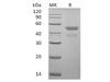 Human ERP44 Recombinant Protein (RPES3182)