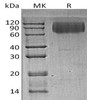 Human LAMP2/CD107b Recombinant Protein (RPES3183)