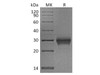 Cynomolgus CD40L receptor Recombinant Protein (RPES3192)