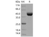 Human LRAP/ERAP2 Recombinant Protein (RPES3219)
