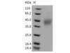 Mouse SLAMF6/Ly108 Recombinant Protein (His Tag) (Active) (RPES3225)