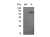 Mouse TSLP Receptor/CRLF2 Recombinant Protein (RPES3226)