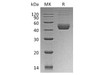 Human CTLA4 Recombinant Protein (RPES3230)