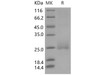 Human CD160/BY55 Recombinant Protein (aa 158, His Tag) (Active) (RPES3233)