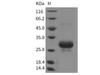 Rat CTHRC1 Recombinant Protein (His Tag) (RPES3236)