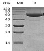 Human Legumain/LGMN Recombinant Protein (RPES3243)