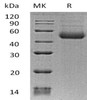 Human ST8SIA1 Recombinant Protein (RPES3245)