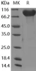 Human CADM4/IGSF4C/NECL-4 Recombinant Protein (RPES3253)
