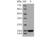 Human PDZD11/PDZK11/PISP Recombinant Protein (His Tag) (RPES3254)