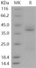 Human CD69 Recombinant Protein (aa 6299, His Tag) (RPES3255)