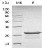 Human PPP1R14A Recombinant Protein (RPES3265)