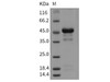 Mouse Pleiotrophin/PTN/HB-GAM Recombinant Protein (Fc Tag) (RPES3278)