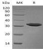 Human Esterase D/ESD Recombinant Protein (RPES3283)