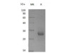 Mouse TIMP1/TIMP Recombinant Protein (RPES3288)