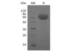 Human IL13RA1 Recombinant Protein (RPES3291)