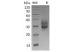 Cynomolgus 4BB/TNFRSF9/CD137 Recombinant Protein (RPES3293)