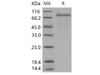 Human CSF2RA/GM-CSFR Recombinant Protein (Fc Tag) (Active) (RPES3300)