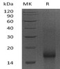 Human Survivin/BIRC5 Recombinant Protein (RPES3302)