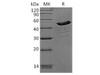 Human Creatine Kinase BB/CKB Recombinant Protein (RPES3312)