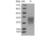 Human SIGIRR/TIR8 Recombinant Protein (RPES3314)