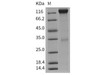Mouse VEGFR2/Flk/KDR Recombinant Protein (Fc Tag) (Active) (RPES3318)