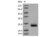 Mouse CLEC6A/Dectin-2 Recombinant Protein (His Tag) (Active) (RPES3319)
