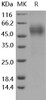 Human OBCAM/OPCML Recombinant Protein (His Tag) (RPES3341)
