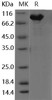 Human KIAA1279 Recombinant Protein (His & GST Tag) (RPES3354)