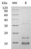 Human CD72/Lyb-2 Recombinant Protein (Trx&His) (RPES3362)