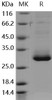 Human RAB27B Recombinant Protein (His Tag) (RPES3374)