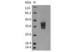 Mouse ESAM Recombinant Protein (His Tag) (RPES3378)