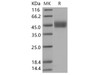 Human FSTL1 Recombinant Protein (His Tag) (RPES3380)