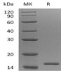 Human EIF1B Recombinant Protein (RPES3382)