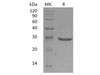 Human GLIPR1 Recombinant Protein (RPES3409)