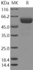 Human CLEC1A/CLEC Recombinant Protein (RPES3413)