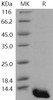 Human S100A8 Recombinant Protein (E.coli, His Tag) (Active) (RPES3414)