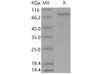 Mouse VE-Cadherin/CDH5 Recombinant Protein (His Tag) (RPES3425)