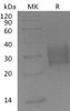 Mouse TGFBR2 Recombinant Protein (RPES3446)