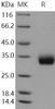 Human ULBP2/N2DL-2 Recombinant Protein (His Tag) (RPES3475)