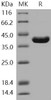 Human ITCH/AIP4 Recombinant Protein (aa 526-903) (RPES3476)