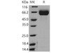 Mouse FGFR1/CD331 Recombinant Protein (His Tag) (RPES3488)