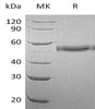 Human PRV1/CD177 Recombinant Protein (RPES3506)