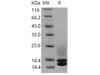 Mouse Cystatin C/CST3 Recombinant Protein (RPES3521)