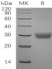 Human CD32a/FCGR2A Recombinant Protein (RPES3525)